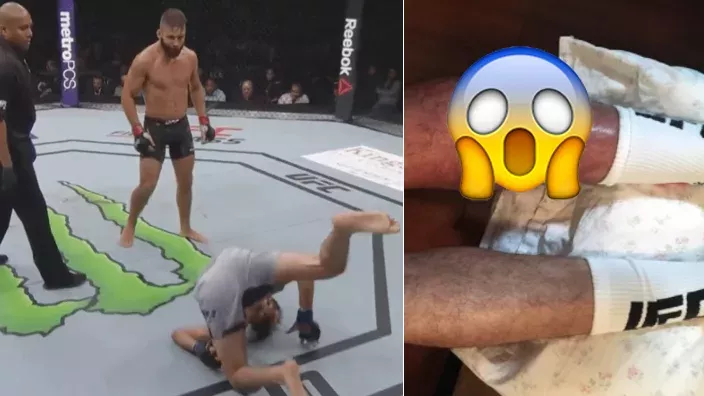 Jeremy Stephens zerstört das Bein von Gilbert Melendez