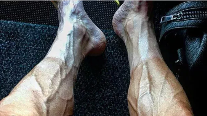 Tour de France: Radprofi schockiert mit Horror-Beinen
