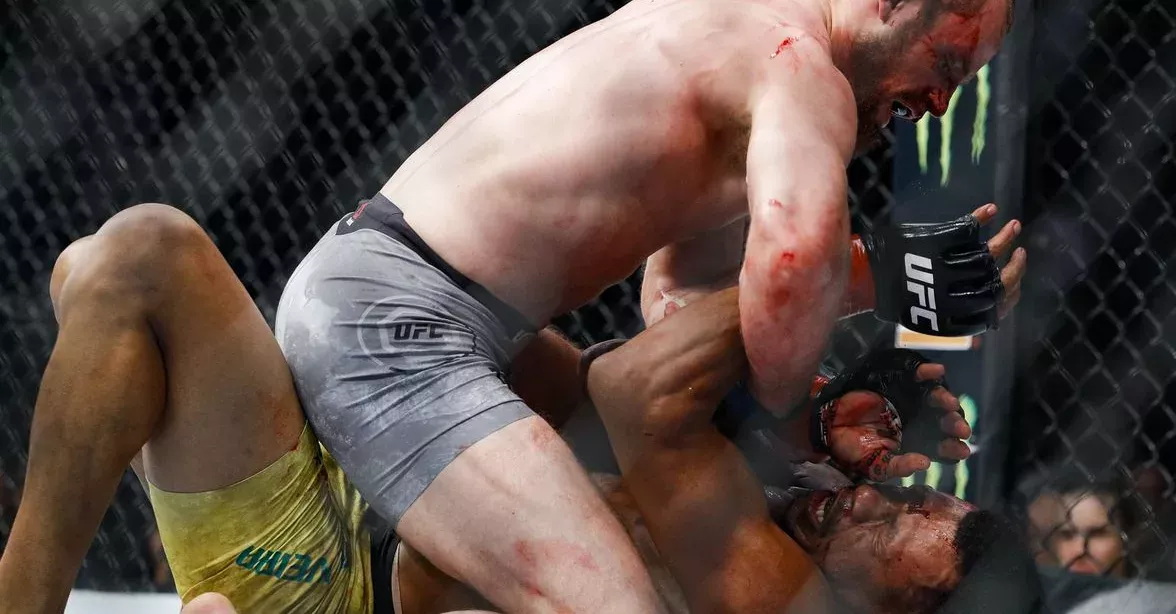 UFC: Alex Oliveiras präsentiert die riesige Narbe auf seiner Stirn