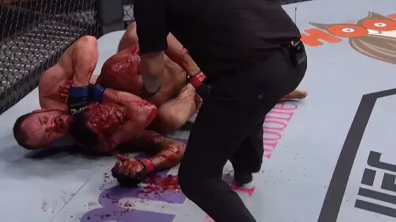 Unschöne Bilder: Der Kampf zwischen Gunnar Nelson und Alex Oliveira endet in einem Blutbad