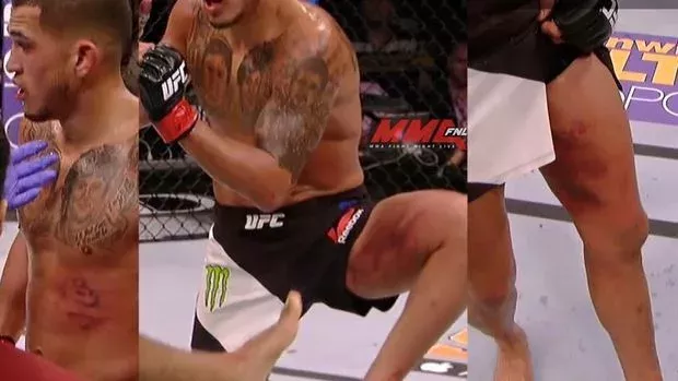 UFC 197: Edson Barbosa wird von Anthony Pettis stark verletzt