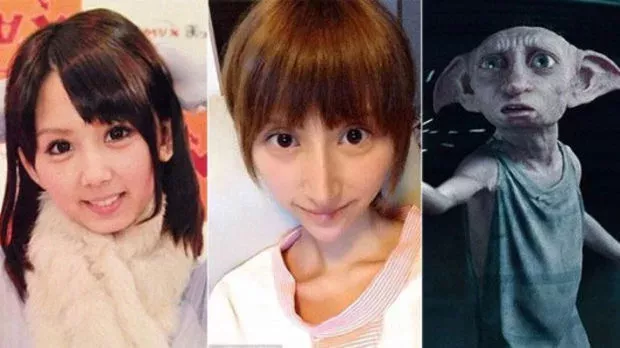 Japan: Ein XXX-Star macht eine Schönheitsoperation, um wie Dobby, der Elf aus Harry Potter, auszusehen
