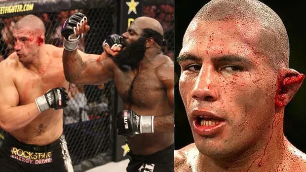 Kimbo Slice: Der Tag an dem er das Ohr von James Thompson zerfetzt hat