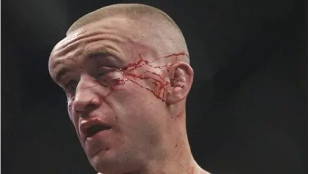 MMA: Die schlimmsten Verletzungen, die je im Oktagon gesehen wurden