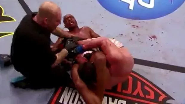 MMA: Die gewaltigste Submission-Technik der Geschichte von Anderson Silva
