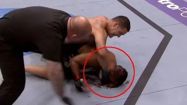 UFC: Chris Weidman gibt alles gegen Mark Muñoz, der bereits am Boden liegt