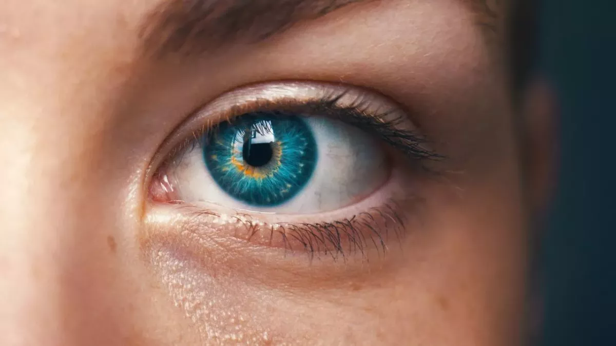 Auge, Iris, Farbe, Krankheit
