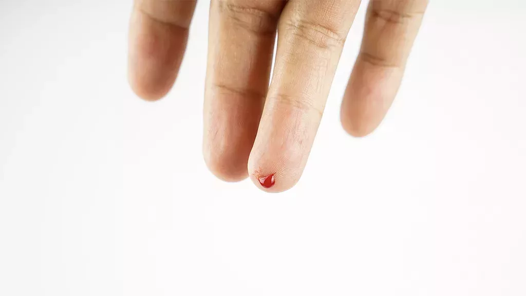 Bis zur Ohnmacht: Aus diesem Grund wird vielen Menschen schlecht beim Anblick von Blut