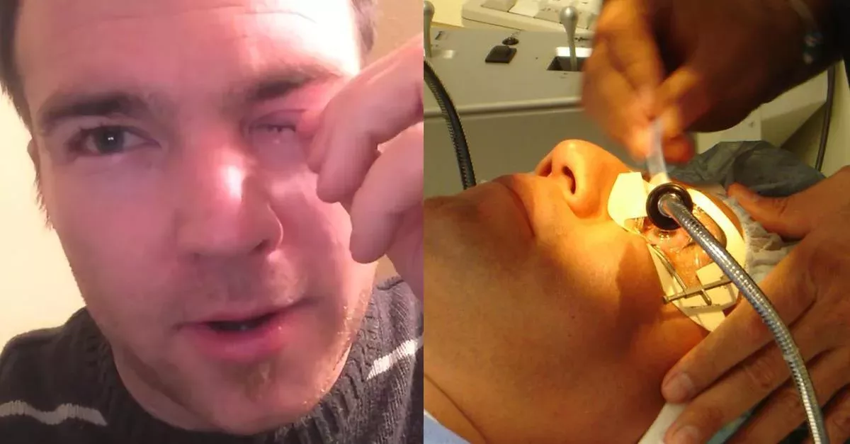 Mann klagt über Juckreiz: Dann findet sein Arzt etwas Unglaubliches in seinem Auge!