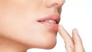 Herpes labialis (Lippenherpes): Ansteckung, Ursachen, Symptome, Dauer, Behandlung und Therapie, wie heilt man es?