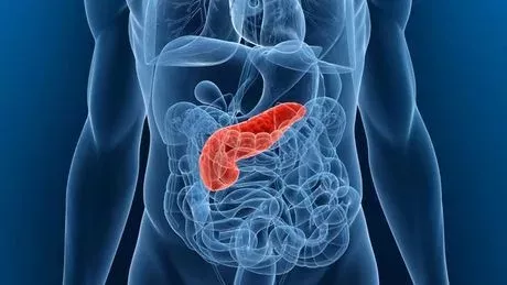 Was ist eine Bauchspeicheldrüsenentzündung: akute und chronische Pankreatitis, Ursachen, Symptome, Therapie