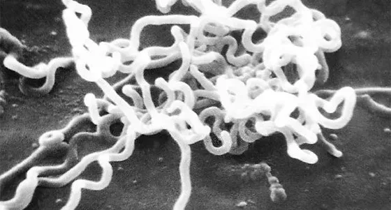 Was ist Syphilis? Symptome, Test, Übertragung, Ansteckung, Behandlung und Therapie