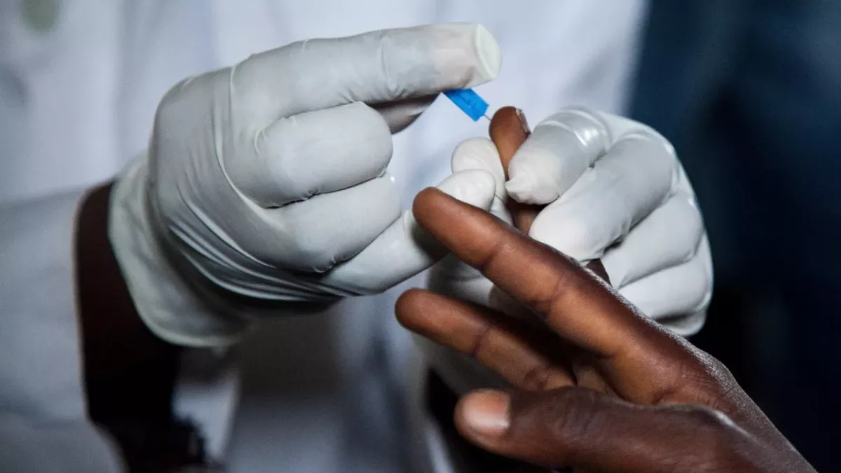 Durch Corona-Impfung könnte Aids zunehmen