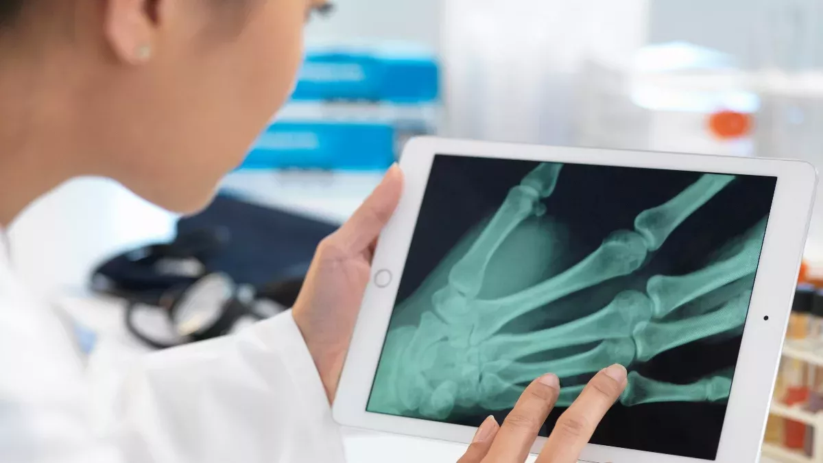 Nach nur einem Jahrzehnt hat das Smartphone begonnen, unsere Hände zu verformen