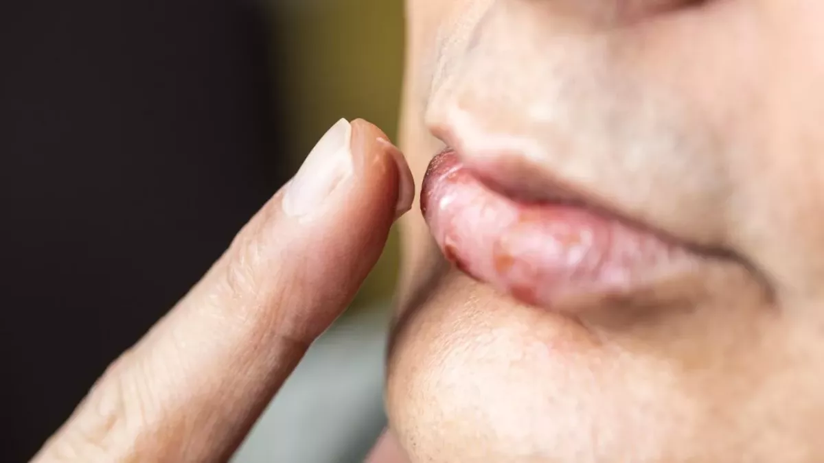 Verhindert Lippenbalsam die Ausbreitung von Covid-19?