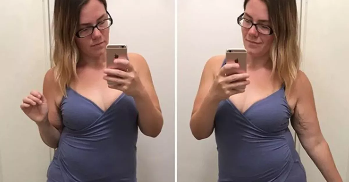 Bodyshaming nach Schönheits-OP