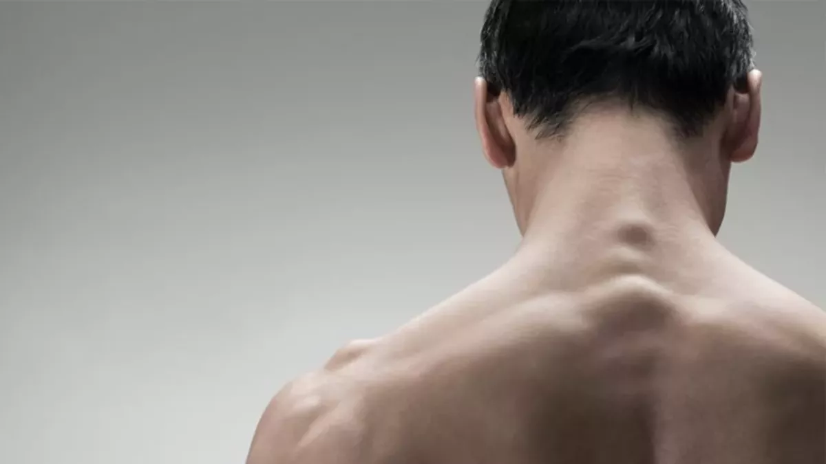 Mann nimmt sein eigenes Sperma als Medikament