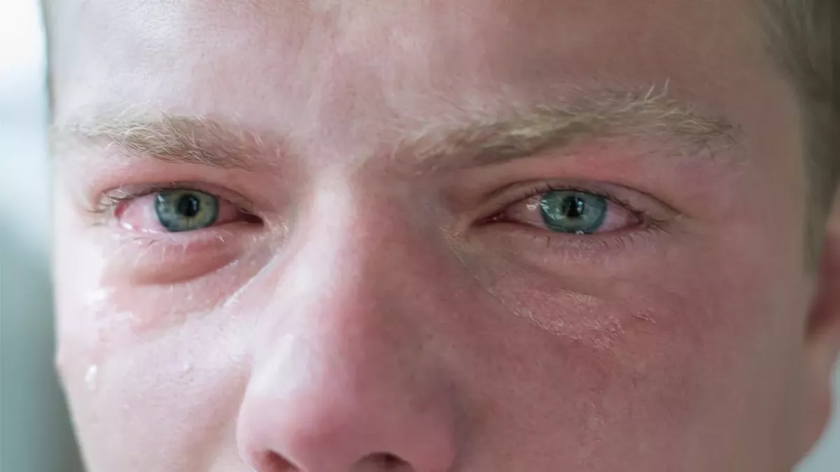 Aus diesem erstaunlichen Grund röten sich unsere Augen nach dem Weinen