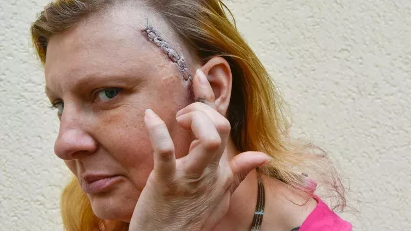 Mann (33) schlägt Frau (44) fast tot: Das Urteil sorgt für Empörung!