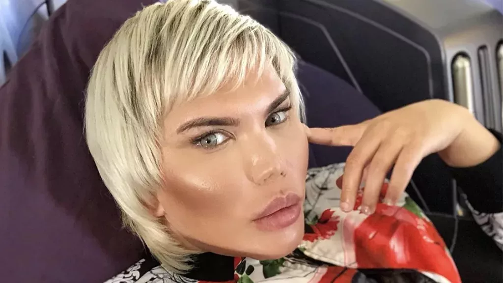 Rodrigo Alves kämpft jetzt mit den Folgen seiner 11 Nasen-OPs