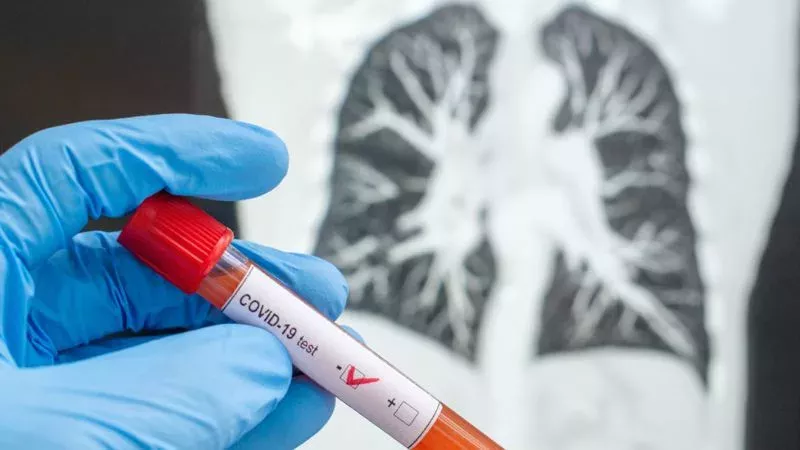 Ab welchem Zeitpunkt ist ein Covid-19-Patient nicht mehr ansteckend?