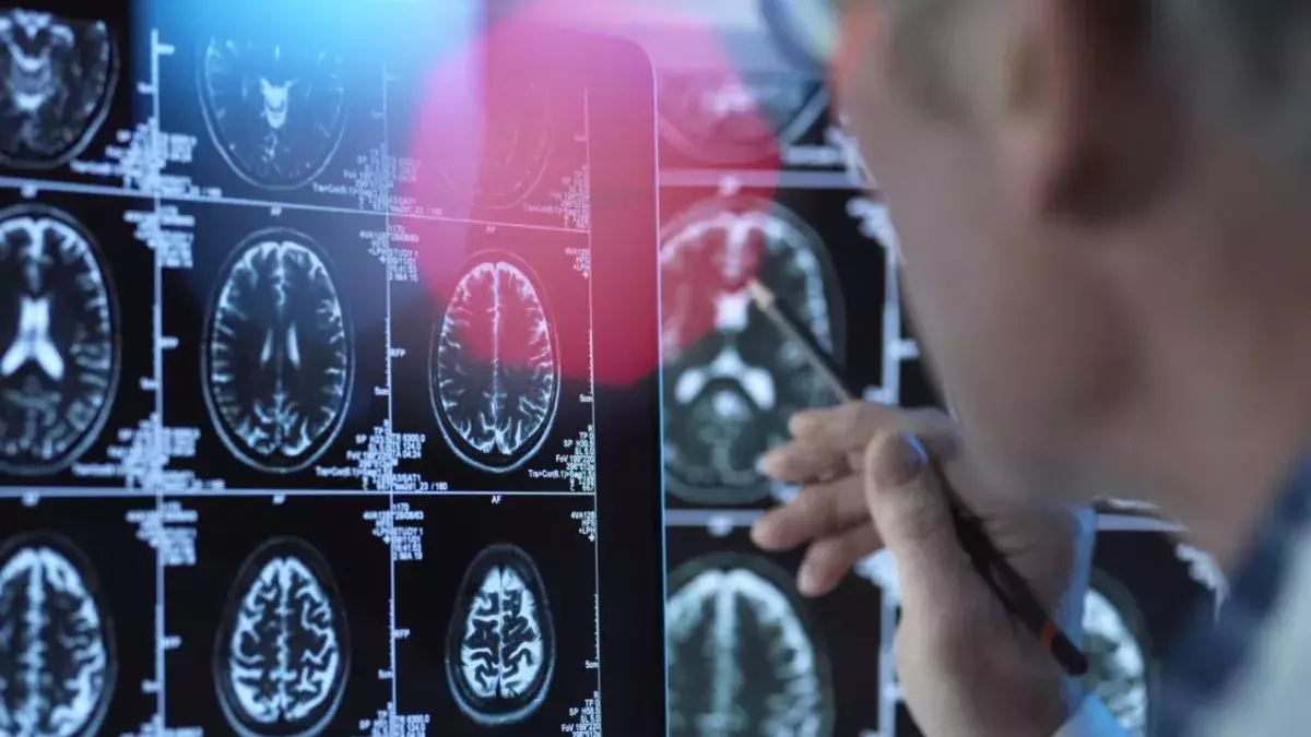 Alzheimer: Erster Nasenspray-Impfstoff soll am Menschen getestet werden