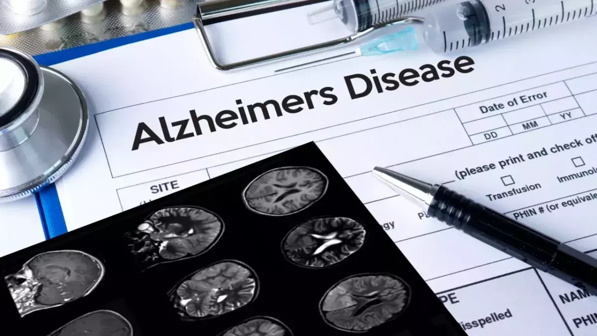 Alzheimer