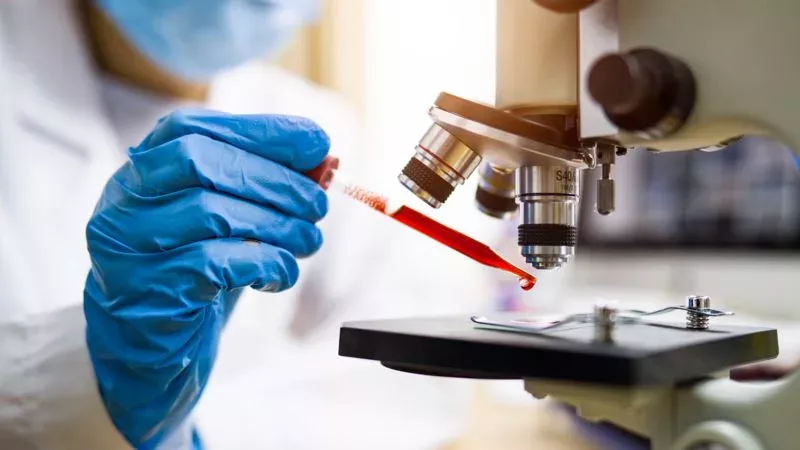Coronavirus: Mit diesen Folgeerscheinungen sollten geheilte Patienten rechnen
