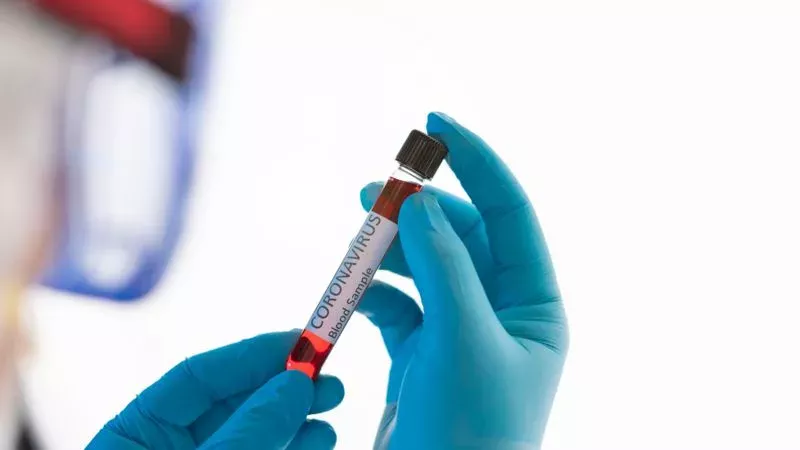 Covid-19: Diese Studie zu infizierten Pflegekräften verrät uns mehr über die Immunität