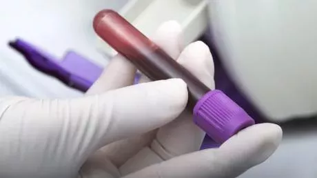 Menschen mit "goldenem Blut" können Millionen von Leben retten