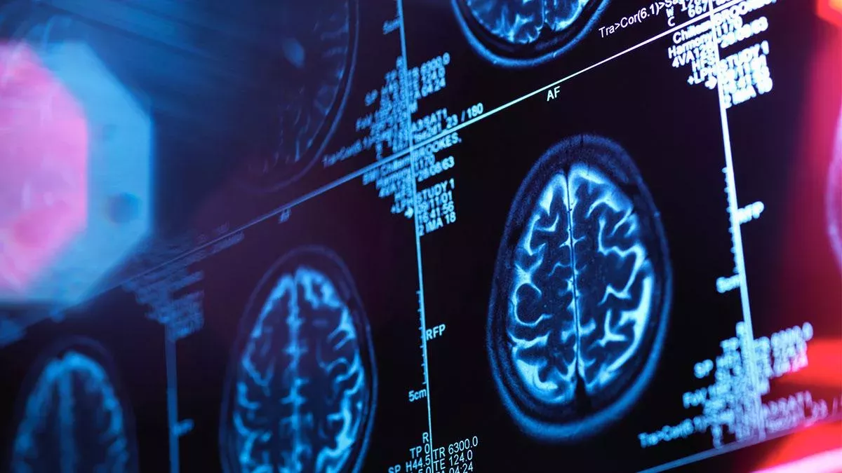 Forschung: Geräusche und Licht wirken sich positiv auf Alzheimer-Patienten aus