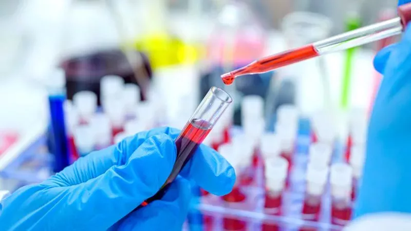 HIV-Patient geheilt 