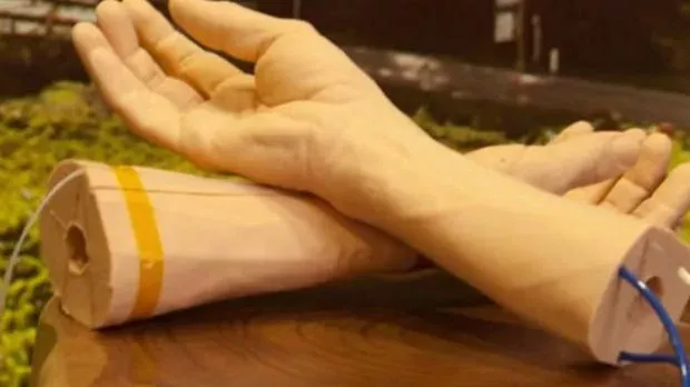 Google entwickelt ein Armband zur frühzeitigen Krebsdiagnose
