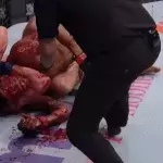 Unschöne Bilder: Der Kampf zwischen Gunnar Nelson und Alex Oliveira endet in einem Blutbad