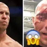 Donald „Cowboy“ Cerrone zeigt seine schreckliche Augenverletzung: Fake oder nicht?