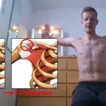 Warum schlecht ausgeführte Liegestütze ein Risiko für irreversible Verletzungen mit sich bringen