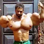 Valdir und seine mit Synthol aufgespritzten Muskeln machen Angst