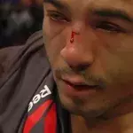 José Aldo vs. Conor McGregor: Eine Kamera erfasst die große Enttäuschung des Brasilianers nach seiner Niederlage