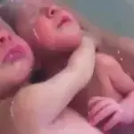 Diese Zwillinge wollen nach der Geburt nicht getrennt werden