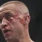 MMA: Die schlimmsten Verletzungen, die je im Oktagon gesehen wurden