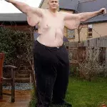 Der dickste Mann der Welt hat fast 300 Kilo abgenommen!