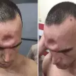Muay-Thai-Kämpfer bekommt Ellenbogenschlag ab. Erst später begreift er, was da passiert ist