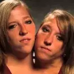 Die siamesischen Zwillinge Abigail und Brittany Hensel konnten ihren größten Wunsch wahr machen