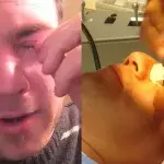 Mann klagt über Juckreiz: Dann findet sein Arzt etwas Unglaubliches in seinem Auge!
