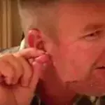 Mann drückt Riesenpickel an seinem Ohr aus: Das Ergebnis schockiert nicht nur ihn