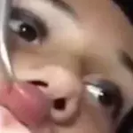 Eine Ärztin zieht einen angsteinflößenden Bewohner aus der Lippe einer Frau