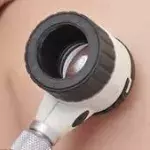 Angiom: Definition, Therapie und Behandlung, wie lässt es sich entfernen und was ist betroffen: Haut, Lippen, Gehirn und Leber?