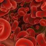 Blutvergiftung: Definition, Anzeichen und Symptome, Ursachen, Behandlung und Therapie, Was ist die Sepsis?