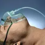 Lungenentzündung (Pneumonie): Symptome, Dauer, bakterielle / virale Lungenentzündung, Behandlung, ist das ansteckend?