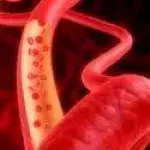Diabetes mellitus: Typ 1, Typ 2, Symptome, Ernährung, Werte, Ursachen, Diagnose und Behandlung